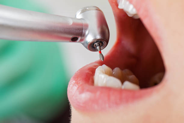 Best Emergency Dentist for Special Needs Patients in Laurinburg, NC